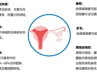 多囊不仅仅是妇科病